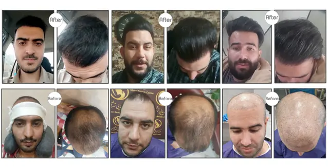 بازدید کلینیکهای تخصصی پوست و مو زیبایی 6 6