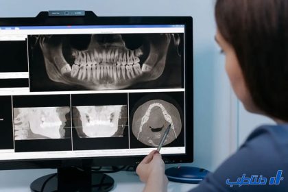 نقش تکنولوژی در پیشرفت تجهیزات دندانپزشکی