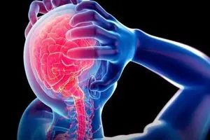 میگرن، میزان سکته را افزایش می‌دهد