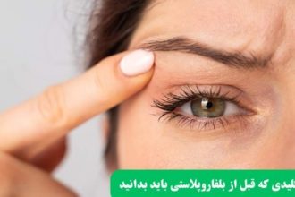 نکات کلیدی که قبل از بلفاروپلاستی باید بدانید