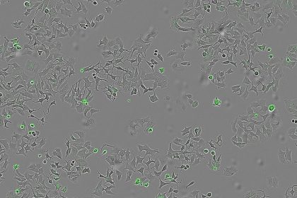 خودکشی سلول‌های سرطانی با باکتری