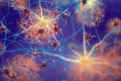 کشف تپش پنهان در مغز که می‌تواند هشداری برای زوال عقل باشد